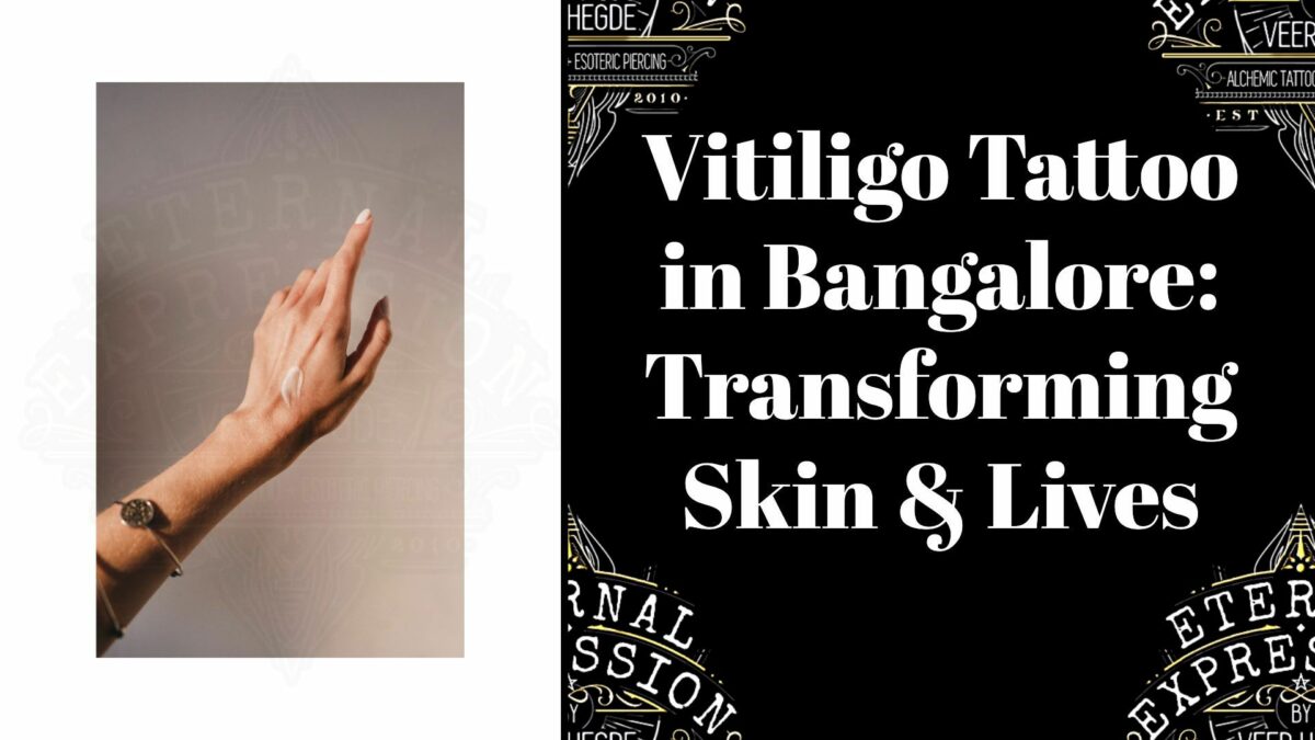 Vitiligo tattoo treatment bangalore - Transforming skin and lives